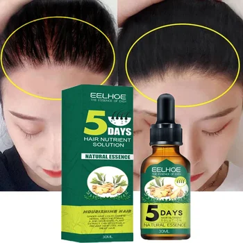 5 Zile De Ghimbir Creșterea Părului Produse Naturale Anti Caderea Parului Preveni Chelie Tratament Cu Creștere Rapidă Hranesc Uscat Deteriorat De Îngrijire A Părului