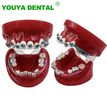 Dentare Ortodontice Dinți Model Cu Paranteze De Metal Corectarea Malocluzie Dentara Tratamentul Model Dentist Student Demo De Instrumente