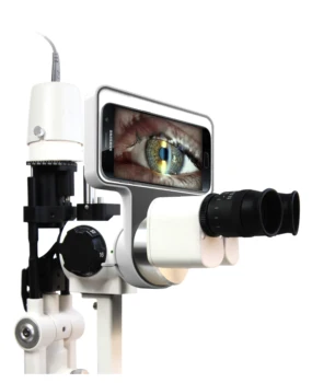 ophthalmical echipamente Digitale Portabile Lampă cu Fantă Adaptor Imagistica Module pentru optometrist